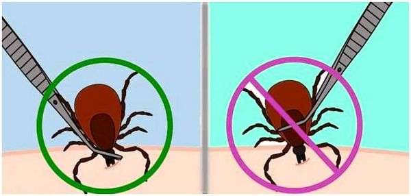 Как заставить клеща вылезти из тела. способы вынимания клеща в домашних условиях