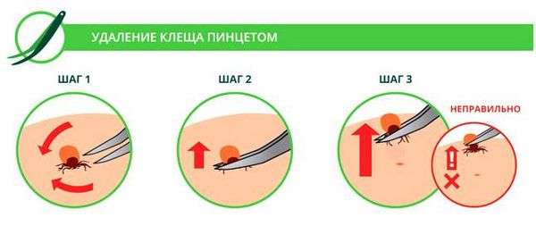 Как убрать клеща с человека в домашних. Что делать при укусе клеща?