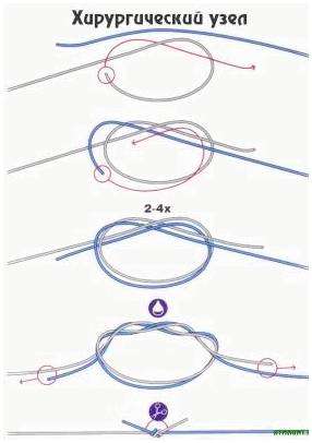Хирургический узел для рыбалки схема. Как вязать хирургические узлы для рыбалки?