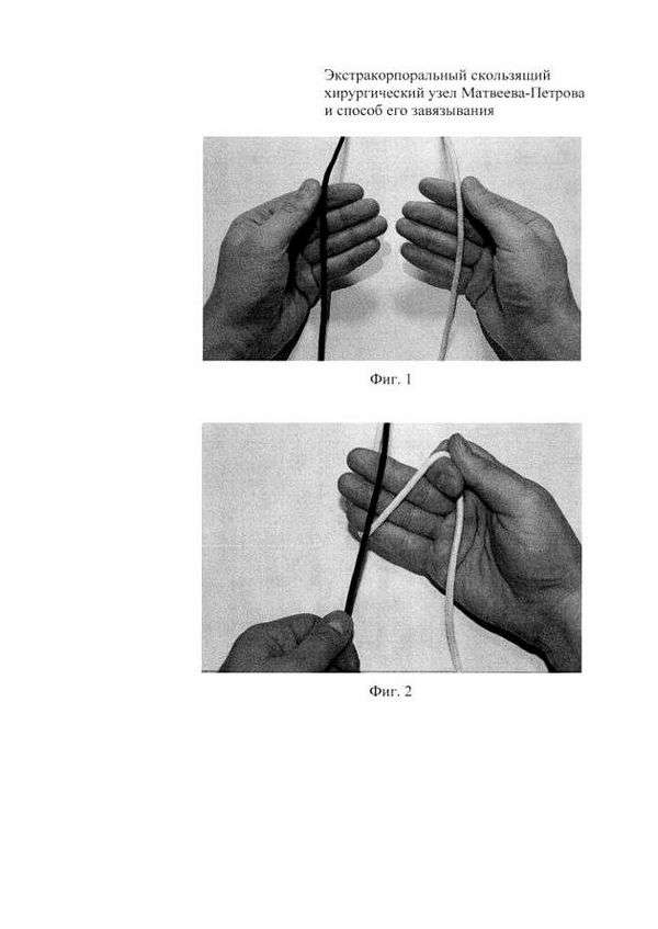 Хирургический узел для рыбалки схема. Как вязать хирургические узлы для рыбалки?