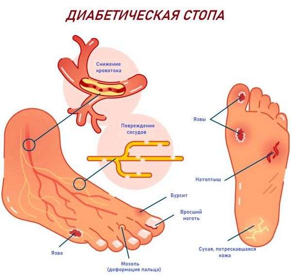 Рана признаки. Раны: что о них нужно знать?