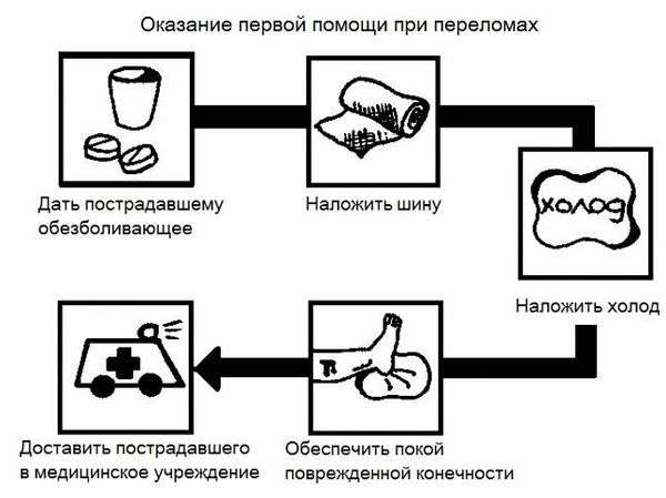 Как оказать 1 помощь при открытом переломе кости. ПМП (первая медицинская помощь) при открытом переломе костей конечности