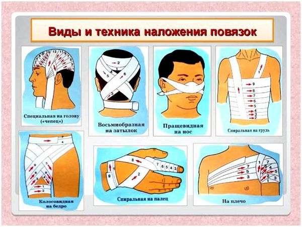 Герметизирующая окклюзионная повязка. Окклюзионная повязка